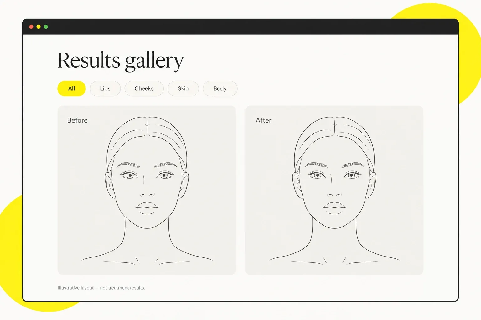 Illustrative clinic gallery interface with treatment filters and matching face drawings, not treatment results.